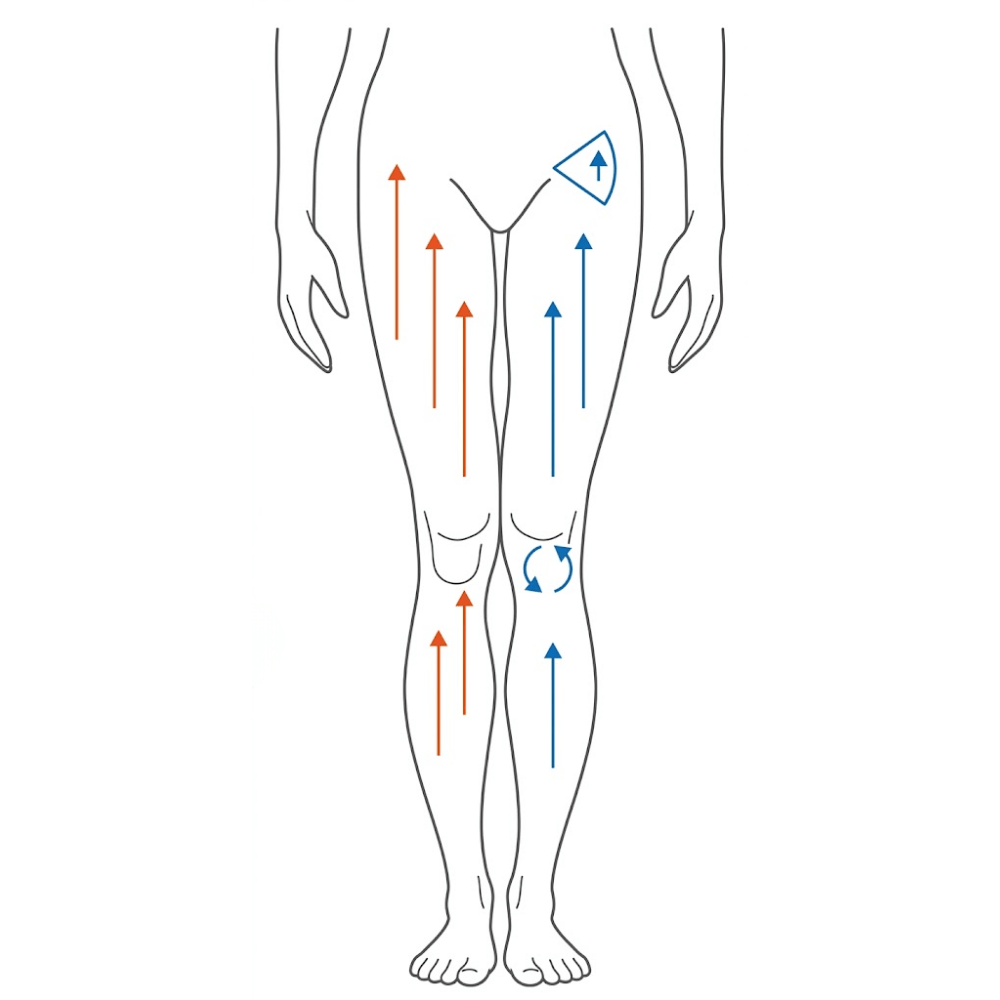 tratamientos anticelulíticos