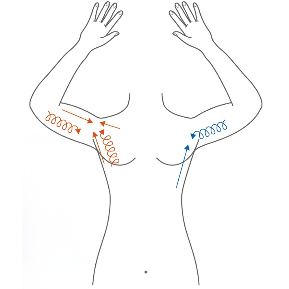 Tratamiento de flacidez